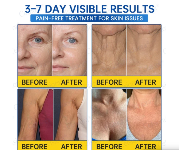 PDRN Anti-wrinkle Firming Cream