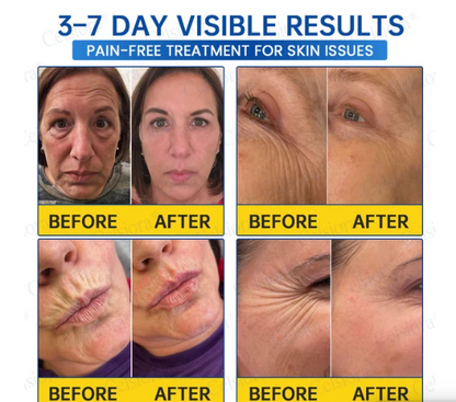 PDRN Anti-wrinkle Firming Cream